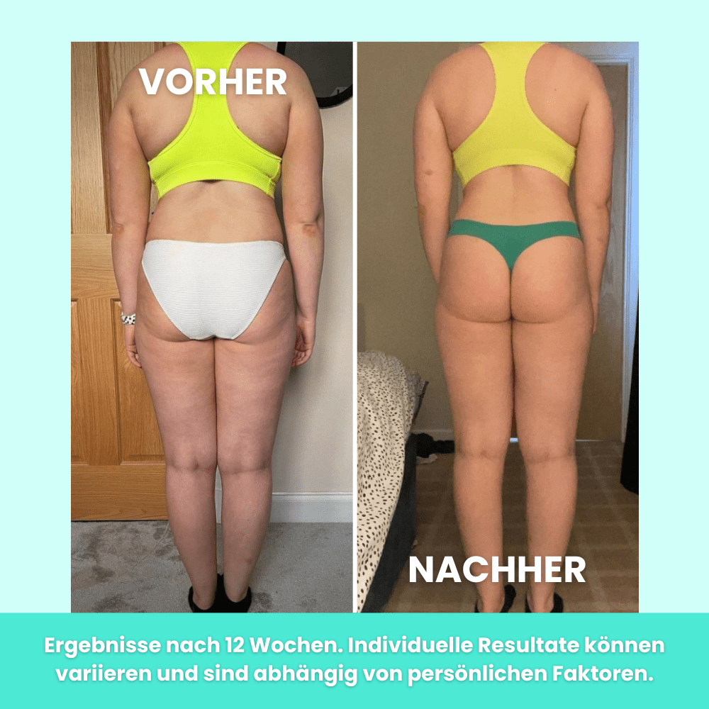ImpulseFit™ – Elektrischer EMS Körperstraffer - Waagemann