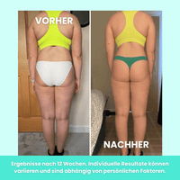 ImpulseFit™ – Elektrischer EMS Körperstraffer - Waagemann