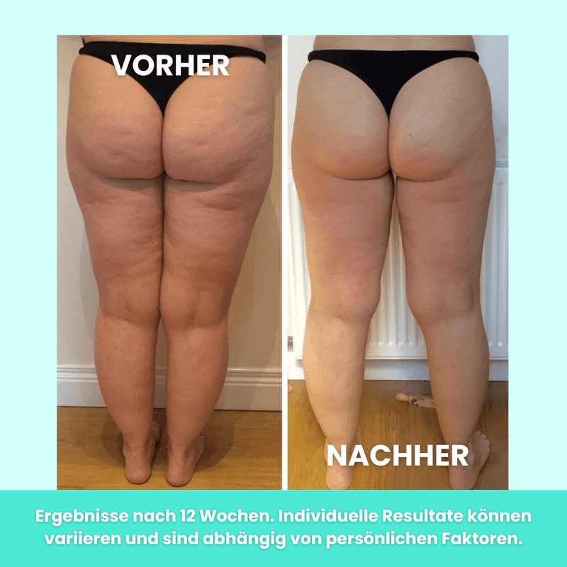 files/impulsefit-elektrischer-ems-korperstraffer-542055.png