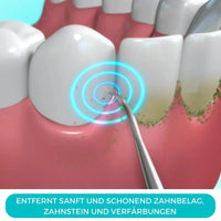 DentaSonic Elektrischer Schall Zahnstein & Plaque Entferner - Waagemann