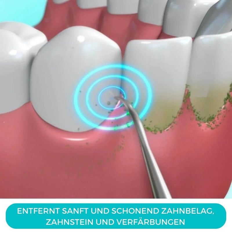 products/dentasonic-elektrischer-schall-zahnstein-plaque-entferner-103429.jpg