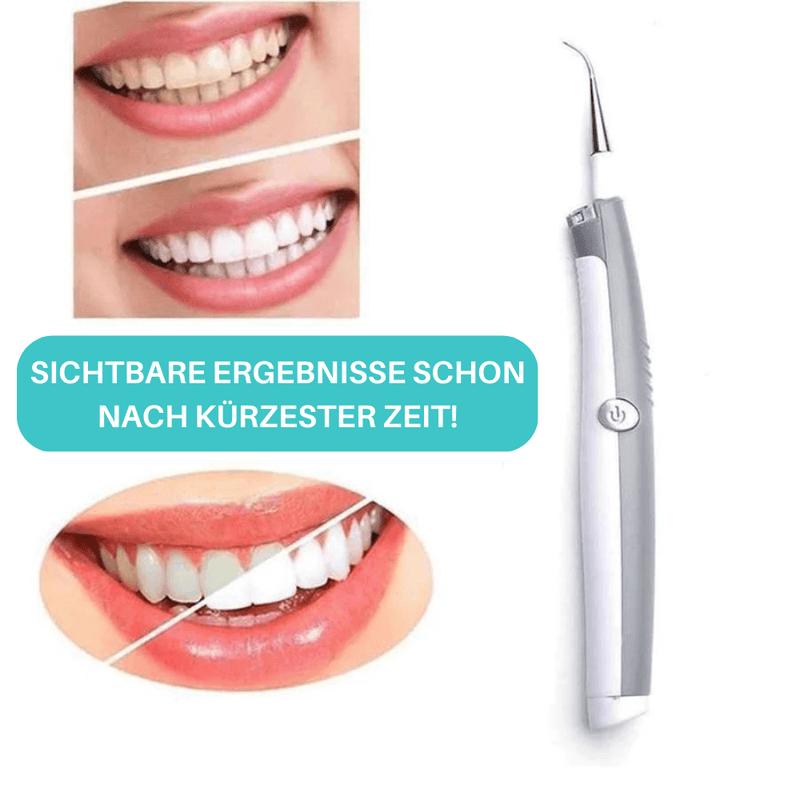 products/dentasonic-elektrischer-schall-zahnstein-plaque-entferner-427995.png
